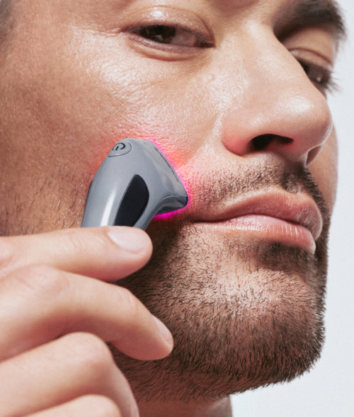 Terapia a luce rossa per l'acne